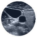 Carotid Ultrasound