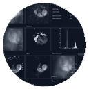 MUGA Heart Scan