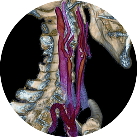 Cancer Imaging Image