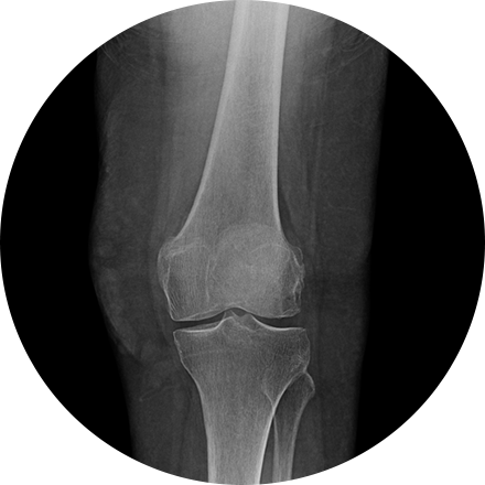 Emergency and Trauma Imaging Image