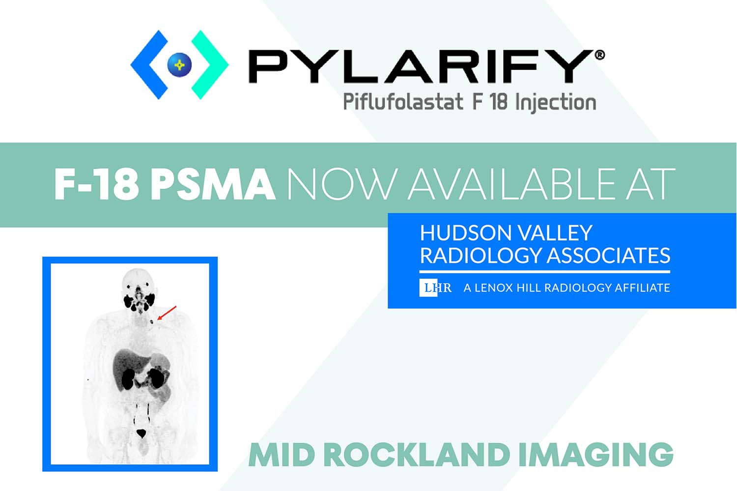  F-18 PSMA PET/CT Locations, Hudson Valley Radiology Associates