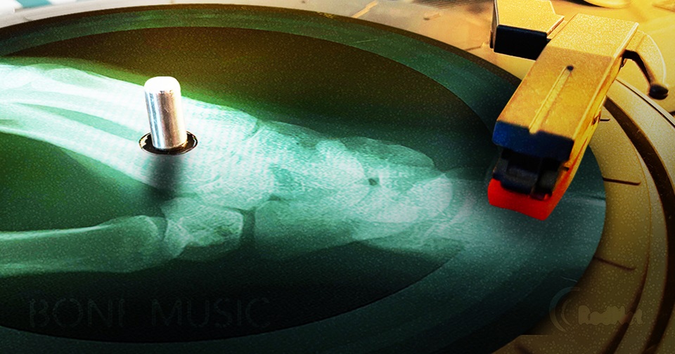 Bone Music: The Fascinating Way X-Rays Were Used to Distribute Illegal Music in the Soviet Union