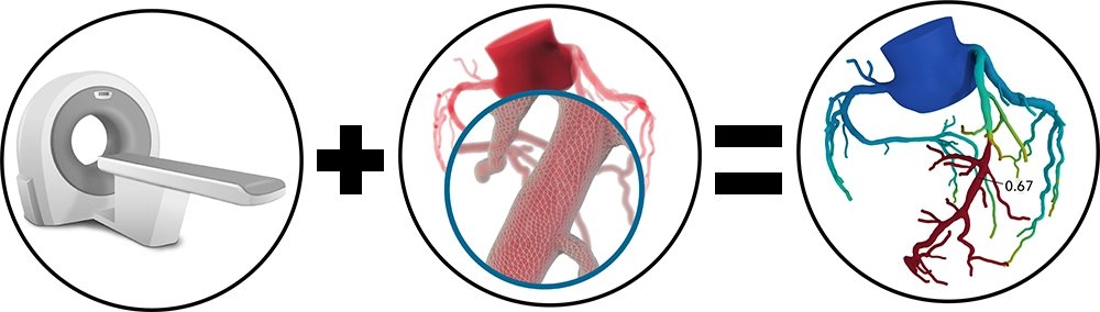 Coronary CTA with Fractional Flow Reserve CT (CCTA w/ FFR CT)