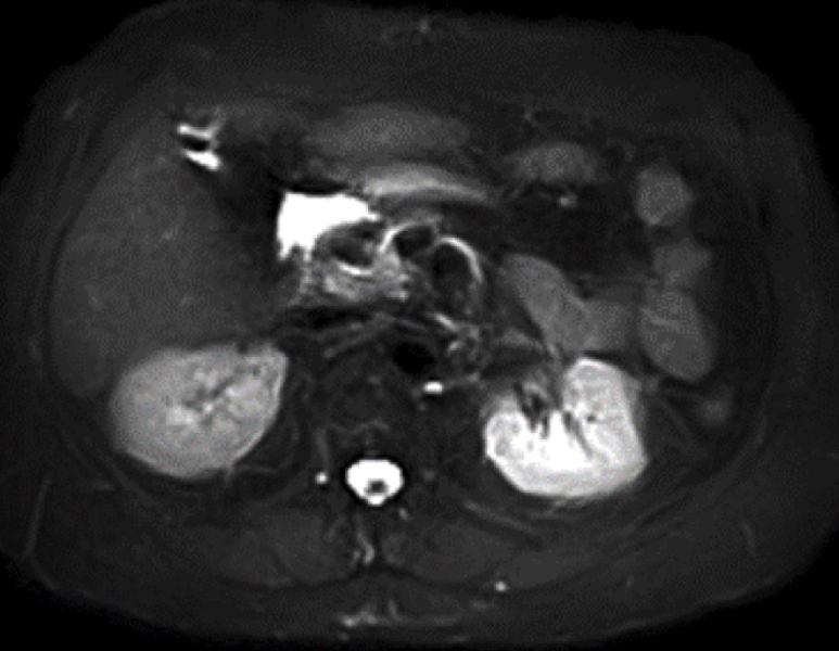 Open MRI Image 1