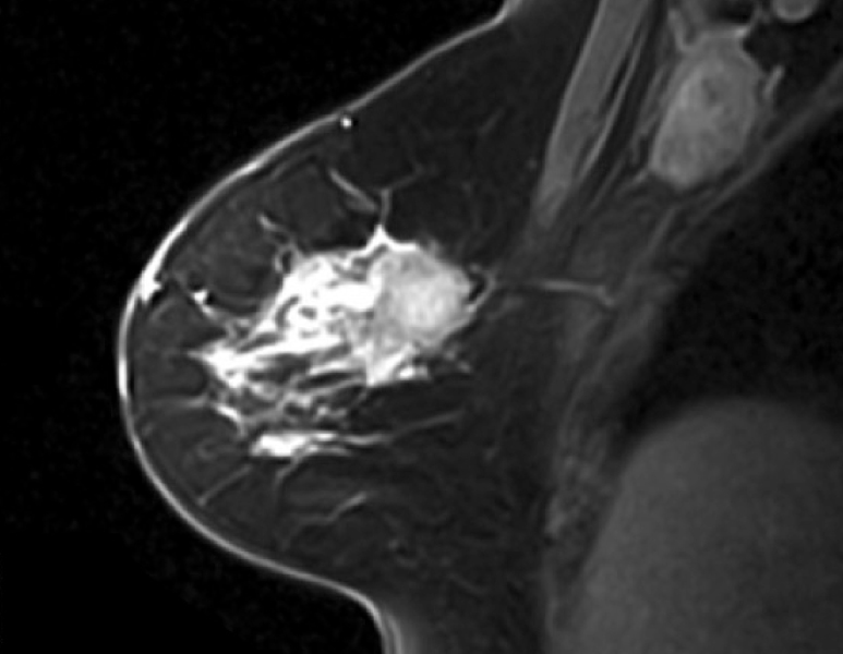 Open MRI Image 3