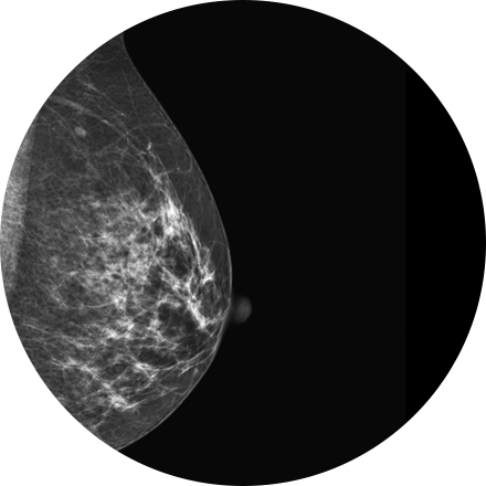 What Happens During a Mammogram? 